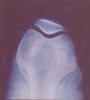 knee image
